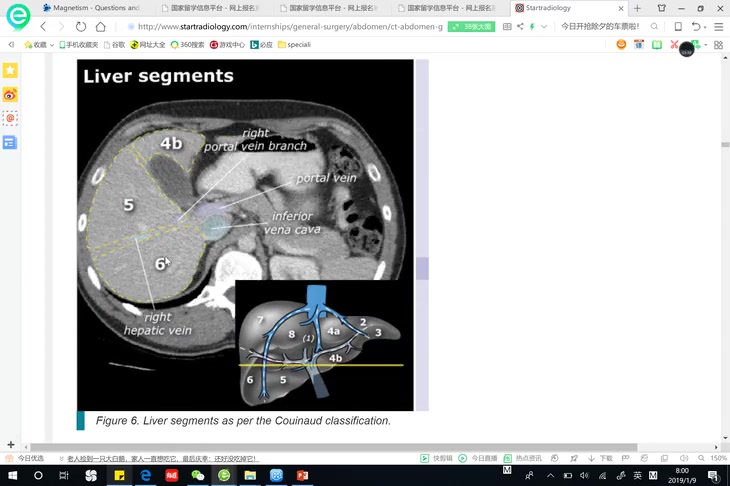 【收藏】10分钟让你记住肝脏的分段门静脉哔哩哔哩bilibili