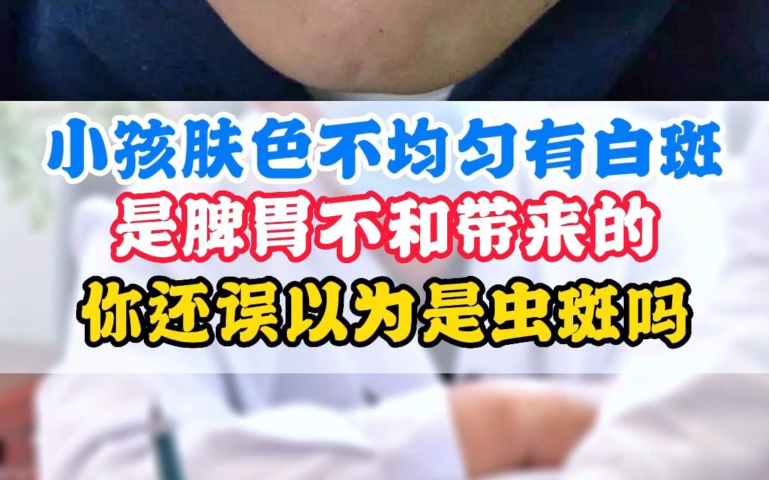 小孩肤色不均匀有白斑,你还误以为是虫斑吗哔哩哔哩bilibili