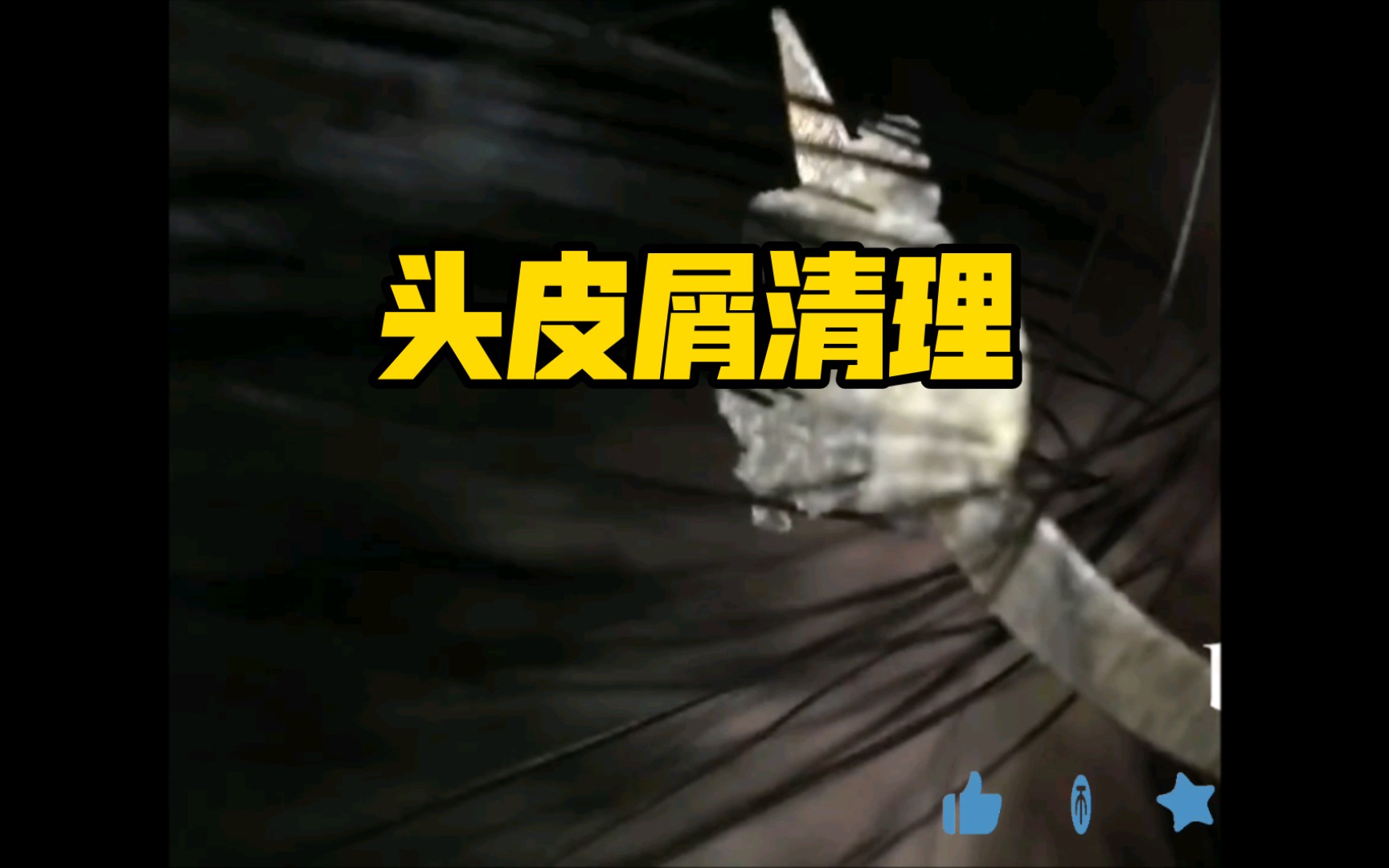 【无人声头皮屑清洁助眠】完整头皮屑清洁过程哔哩哔哩bilibili