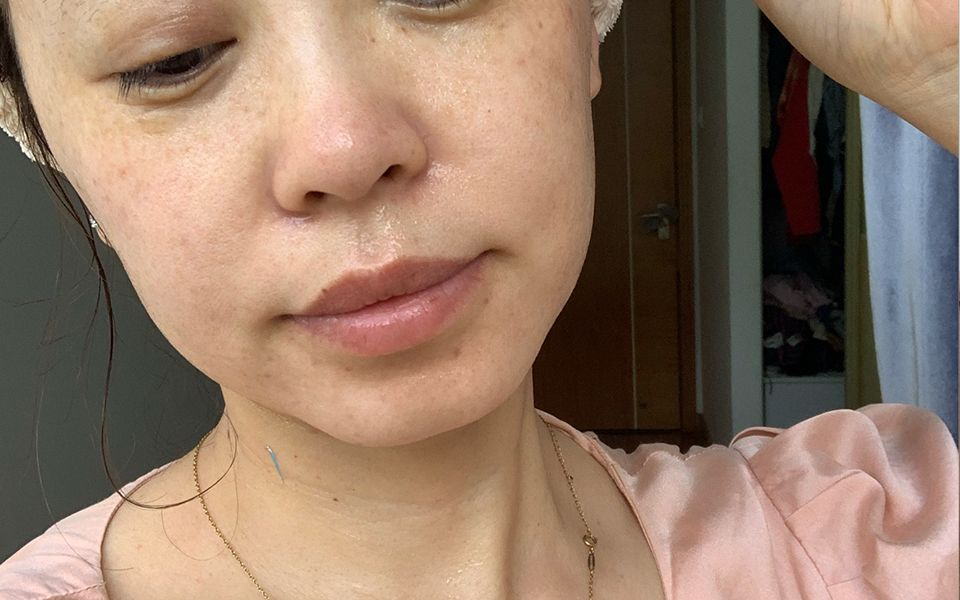 脸长斑黄褐斑怎么去掉!3年色斑人分享祛斑方法,根除斑点不难!