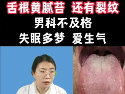 Download Video: 舌根黄腻苔，舌根有裂纹，男科不及格，失眠多梦，爱生气