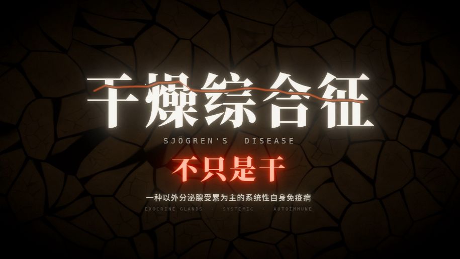 干燥综合征-不只是干