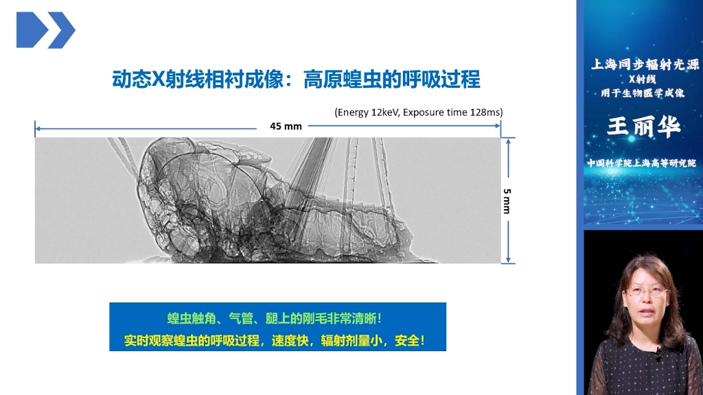 上海光源:X射线用于生物医学成像哔哩哔哩bilibili