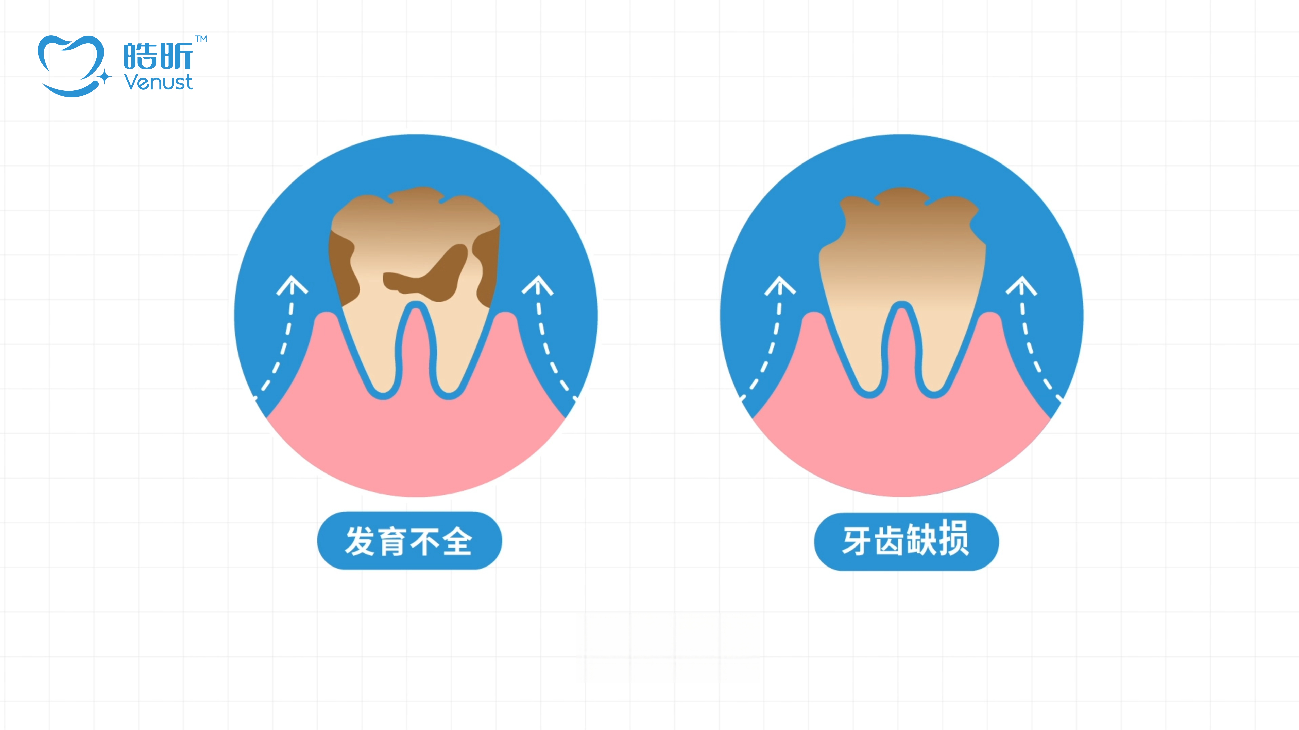 皓齿小课堂 | 四环素牙不是小事!了解成因,守护牙齿健康