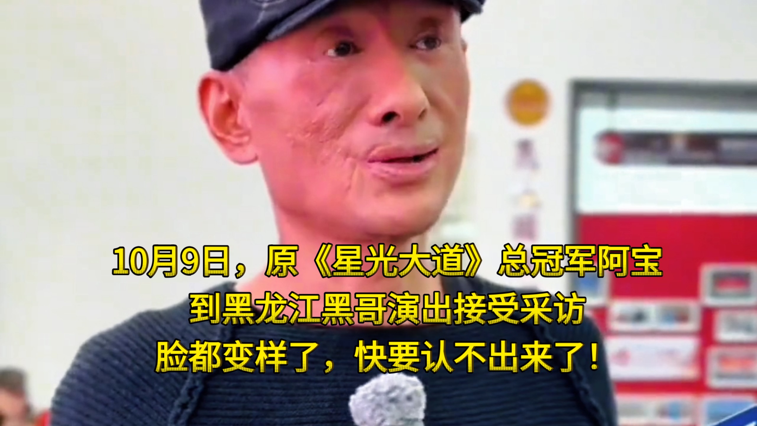 10月9日，原《星光大道》总冠军阿宝到黑龙江黑哥演出接受采访，脸都变样了，快要认不出来了！
