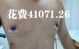 Video herunterladen: 乳头雌化手术实录以及经验分享