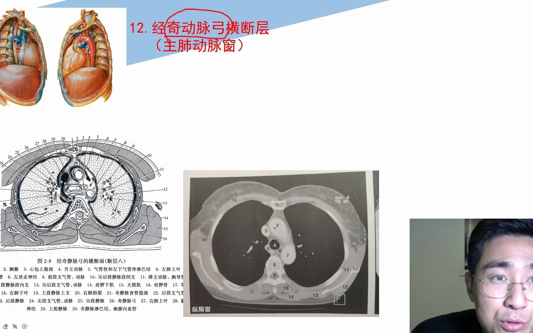 放射医学技术知识点12经奇静脉弓主肺动脉窗的横断层