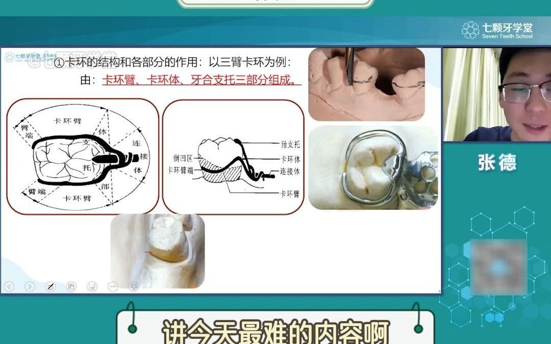 3臂卡环的结构与作用哔哩哔哩bilibili