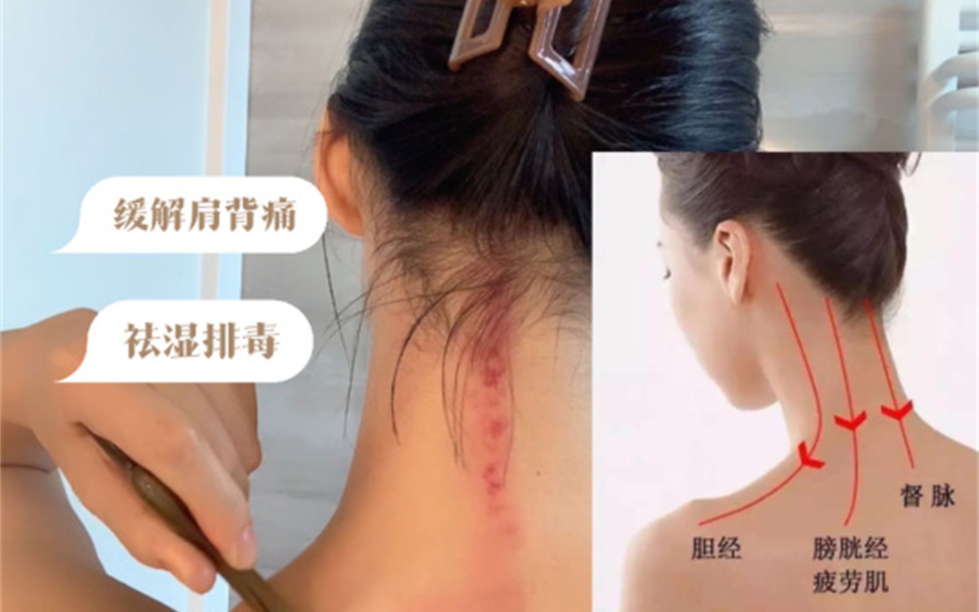 5分钟肩颈刮痧分享|简单有效