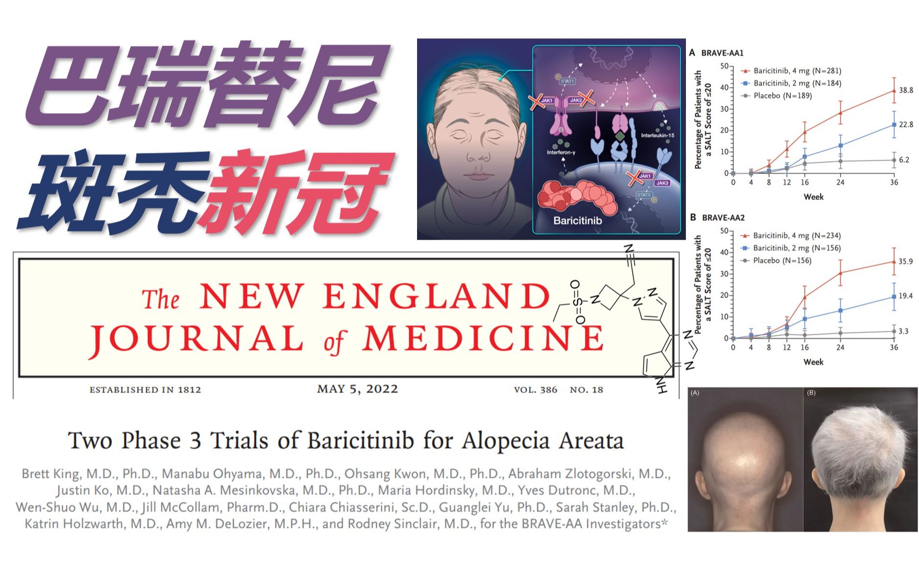 【生物化学】新知11 哦我亲爱的巴瑞替尼 请斑秃和新冠一起离开我好吗?哔哩哔哩bilibili