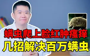 Download Video: 三月不晒被，百万螨虫陪你睡。螨虫这个物种有那么可怕吗？怎么除螨呢？