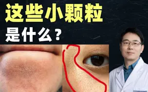 Download Video: 皮肤学博士教护肤：鼻侧和下巴毛孔处的小颗粒怎么办？