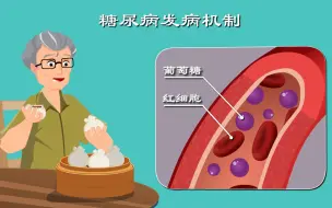 Download Video: 糖尿病4：高高在上的血糖是谁？