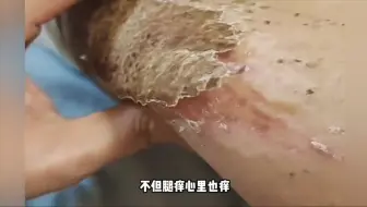 这就是手欠的结局