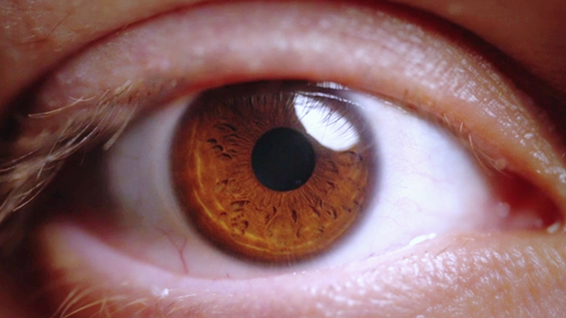 褐色的虹膜,感谢支持