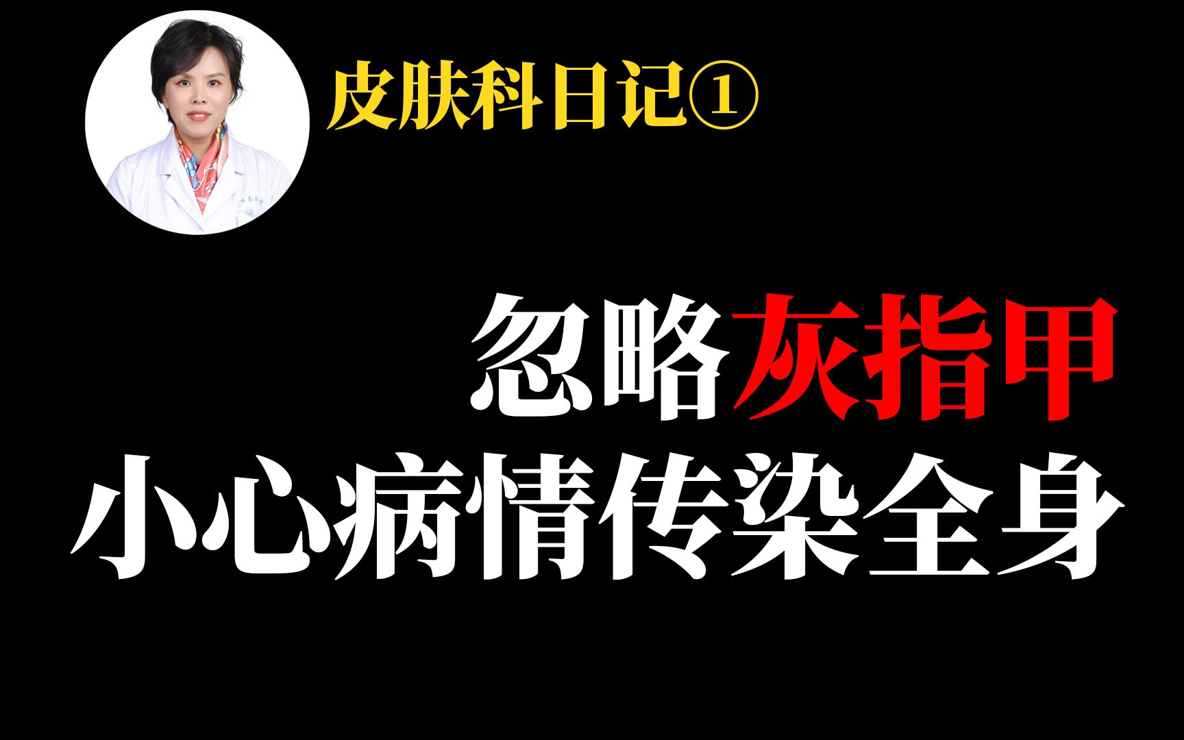 【皮肤科日记】直到病情蔓延全身,这名医生才开始重视自己的灰指甲哔哩哔哩bilibili