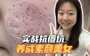 Скачать видео: 坑大到能插秧？！直接轻松逆袭大美女！！