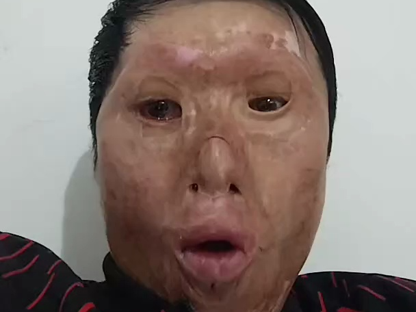 5.13 烧伤易哥 2——中国男主播年鉴