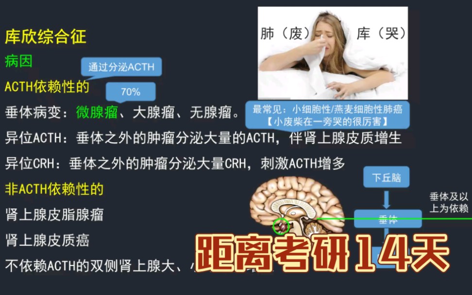 考前必备:库欣综合征辅助检查哔哩哔哩bilibili