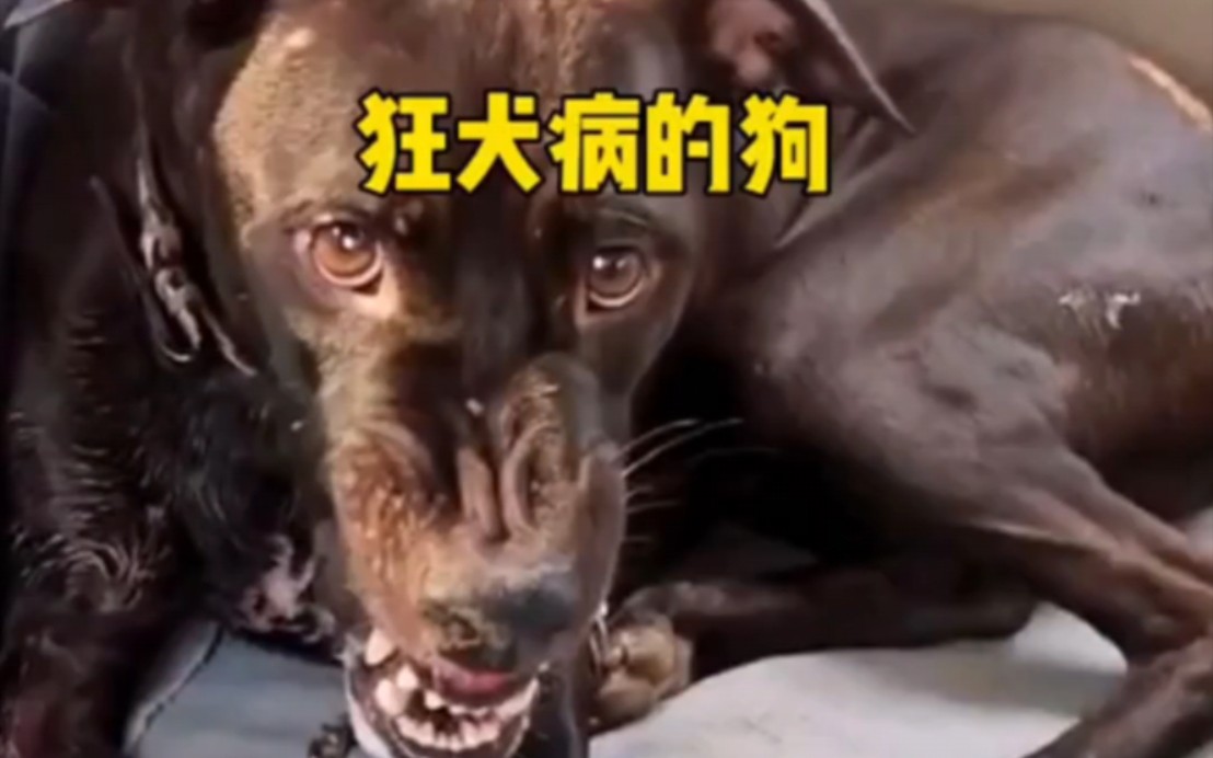 狂犬病人发作图片