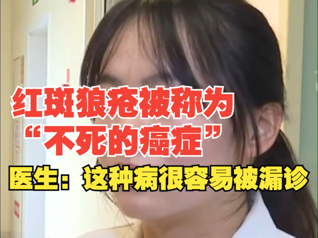 红斑狼疮被称为“不死的癌症”,医生:这种病很容易被漏诊,男女患病比例达到1:9哔哩哔哩bilibili