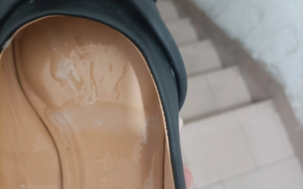 鞋子有不明水状液体 怎么回事