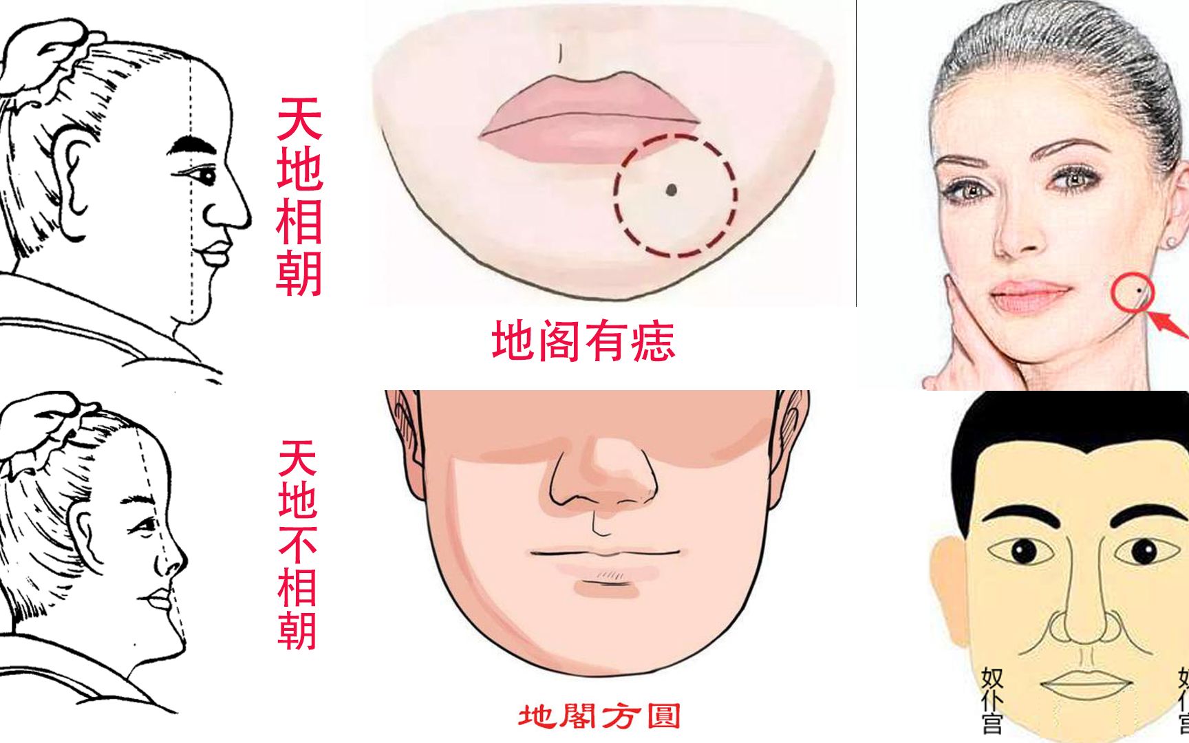 腮上有痣图解图片