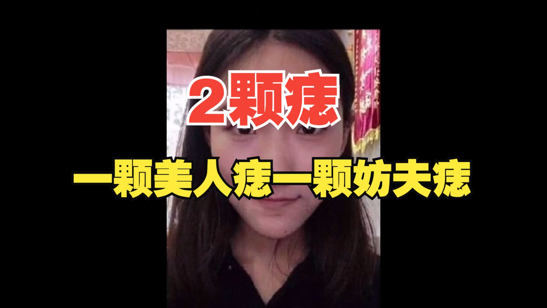 美女面相有2颗痣,一颗美人痣,一颗妨夫痣!哔哩哔哩bilibili