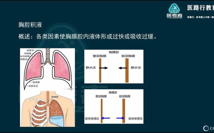 [图]医路行2023年临床-呼吸系统7-1（胸腔积液+血胸）.wmv