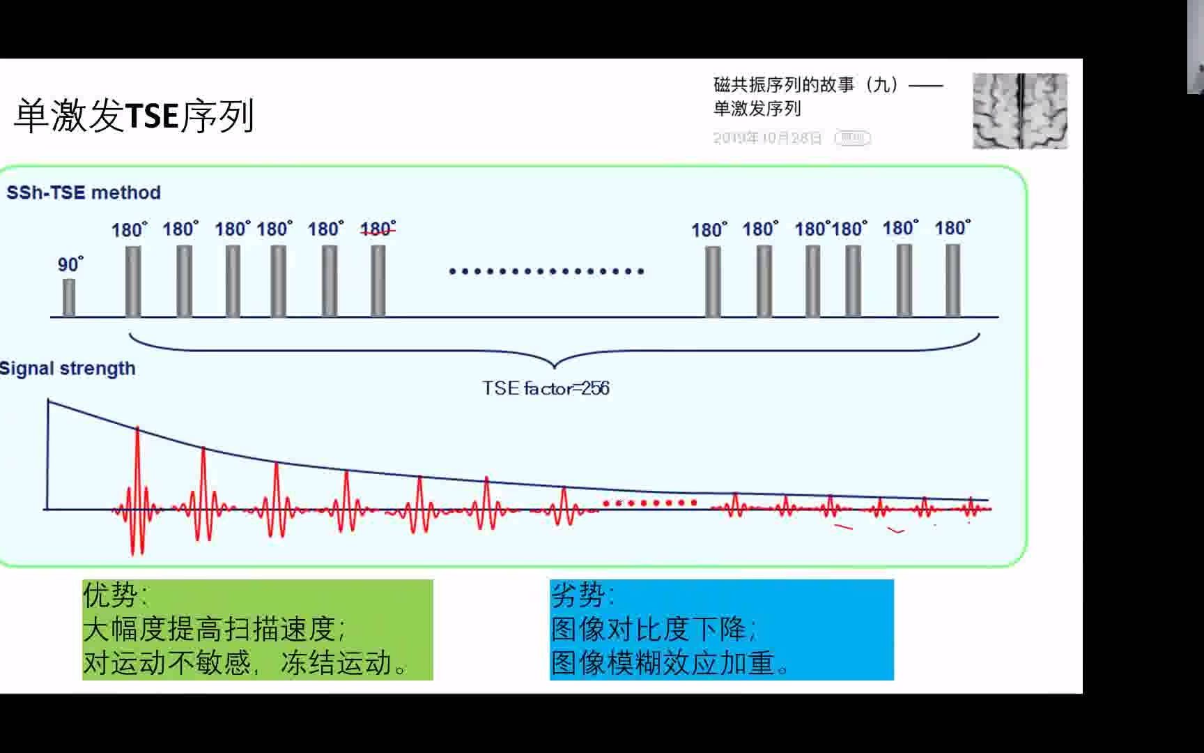 特殊自旋回波序列李懋哔哩哔哩bilibili