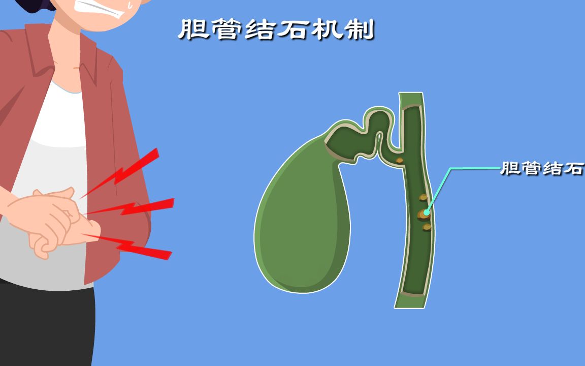 [图]胆管结石2：胆汁，人体的脂肪克星