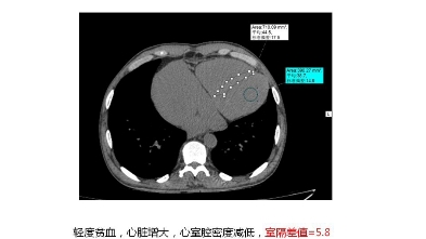 贫血程度测量标准:轻度贫血Hb水平为90~120gL中度贫血Hb水平为60~90g/L重度贫血Hb水平为30~60g/L低于30g/L为极重度贫血.哔哩哔哩bilibili