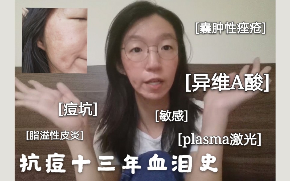 [图]【痤疮治疗】大家印象中的“烂脸”是我努力了十几年的结果|囊肿性痤疮+脂溢性皮炎|10个月异维A酸|两次plasma|护肤爱用品分享