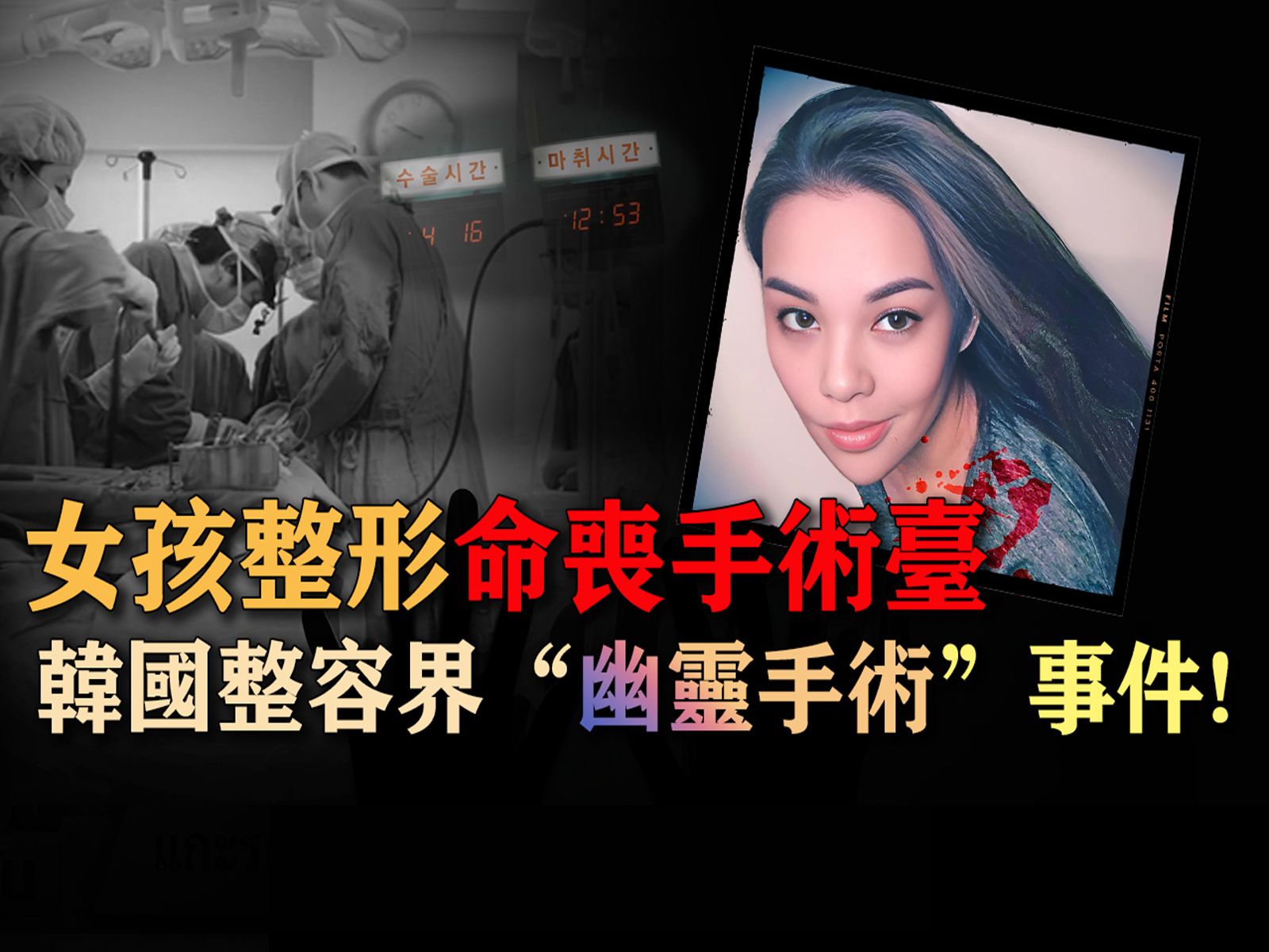 女孩整形为何命丧手术台,揭秘韩国整容界"幽灵手术"事件
