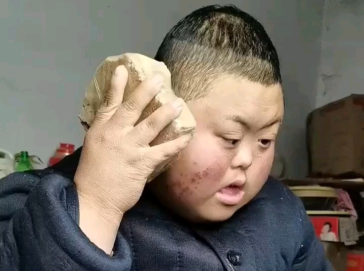 尸斑脸时期小鸭哥拿砖头打电话