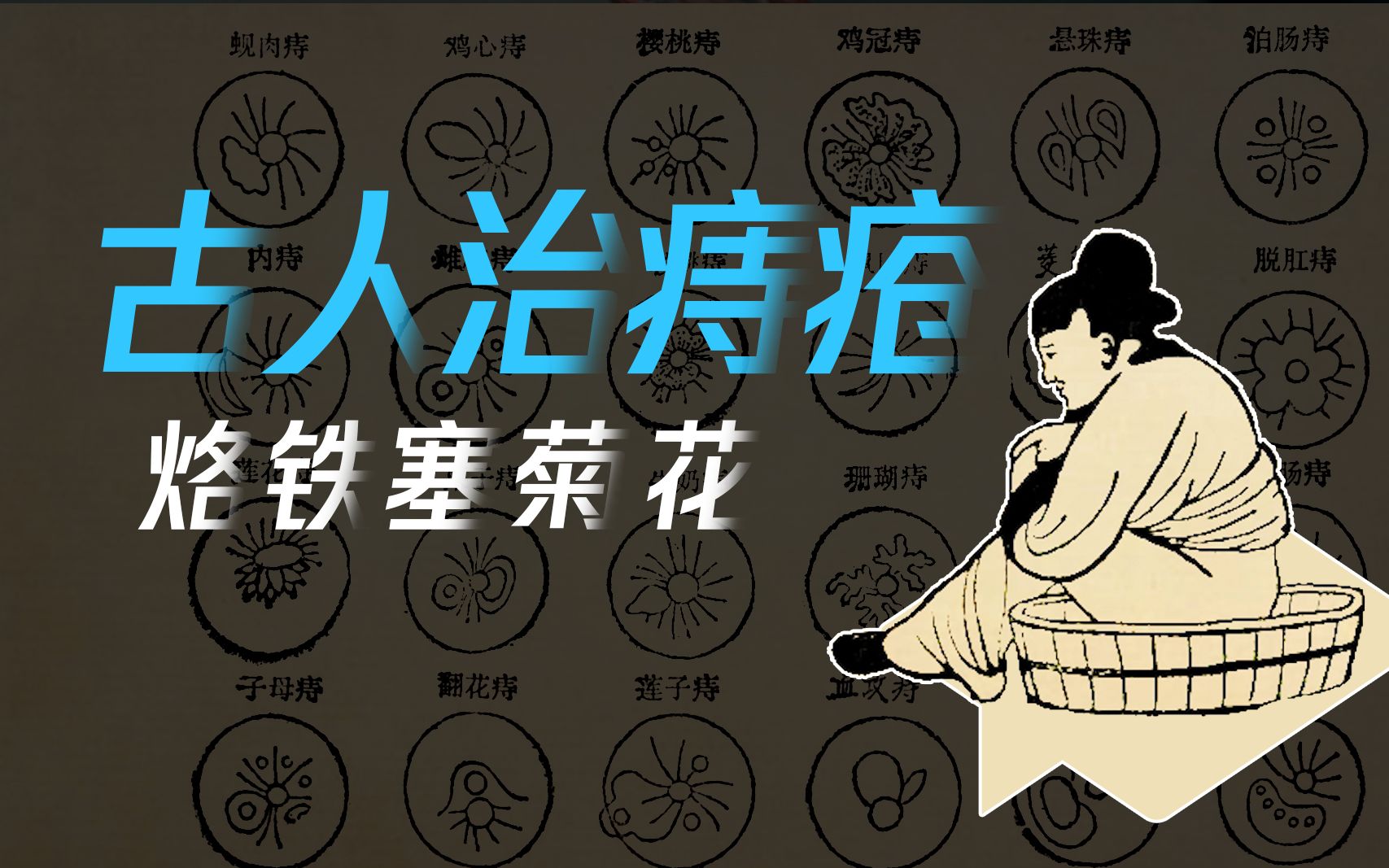 古人怎么治痔疮?10种"兵器"硬怼,看着都疼