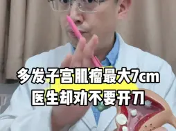 Télécharger la video: 多发子宫肌瘤，最大7cm，恩哥却劝不要开刀！为什么呢？