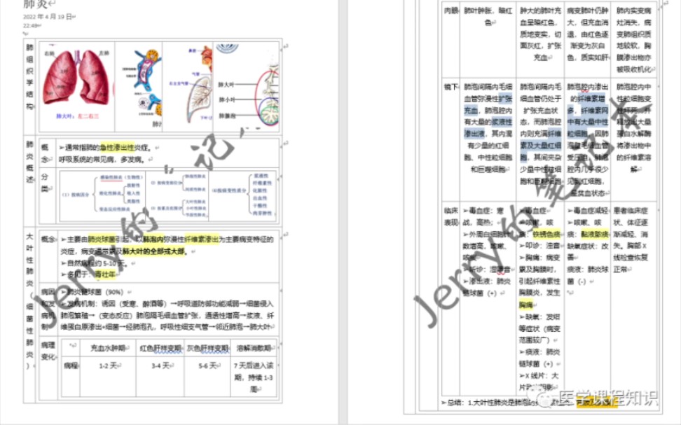 [图]《病理学》呼吸系统疾病总结！干货满满！考前必背！重点总结