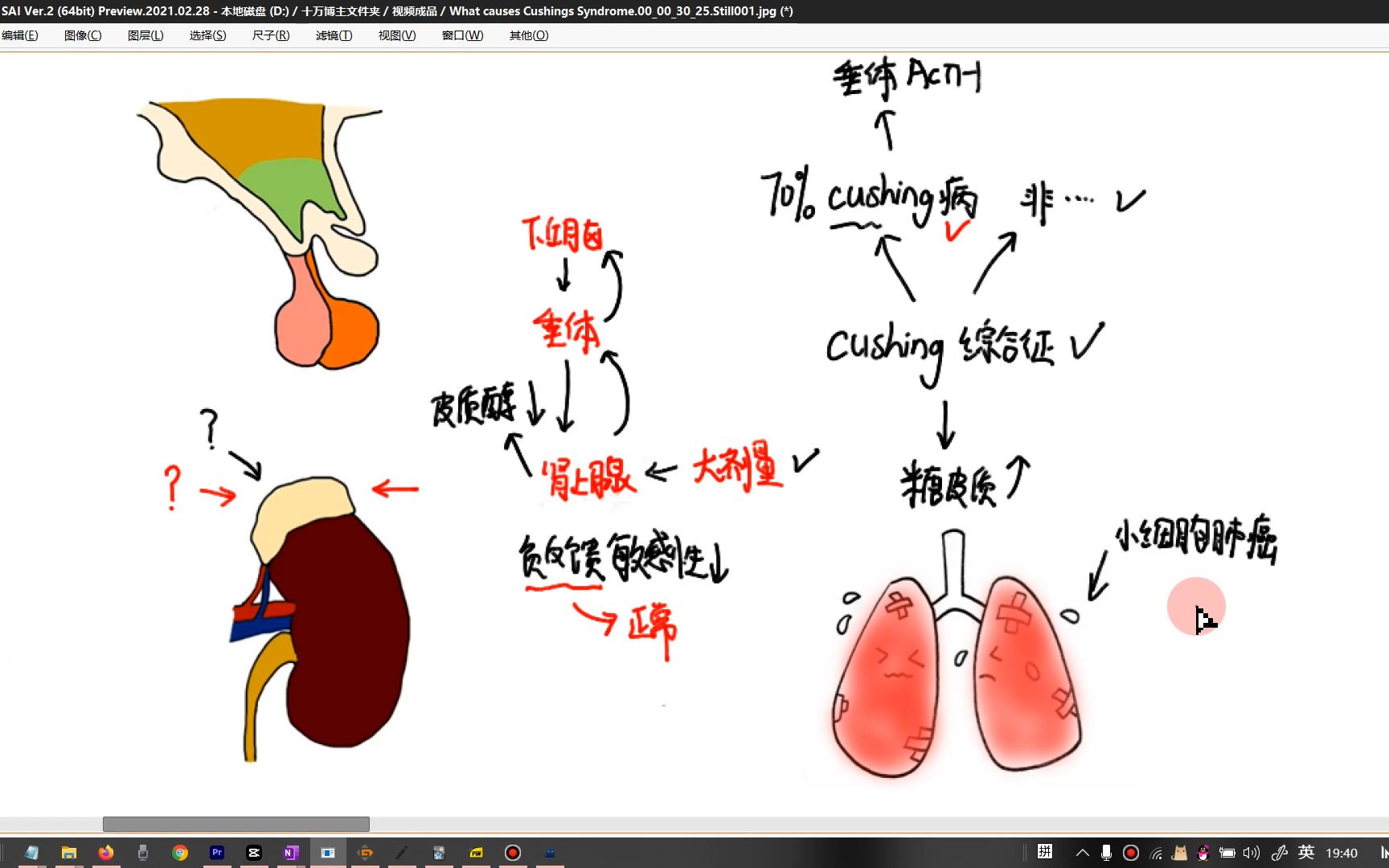 大小剂量地塞米松抑制试验的原理哔哩哔哩bilibili