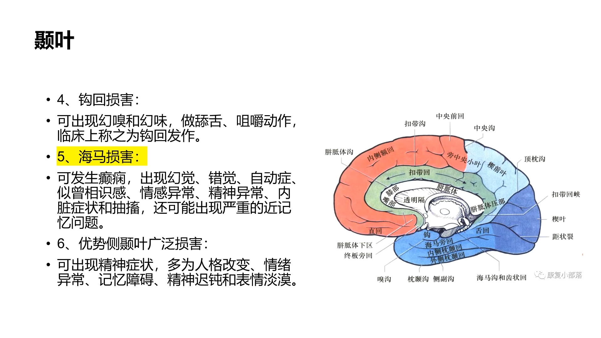 大脑解剖颞叶哔哩哔哩bilibili