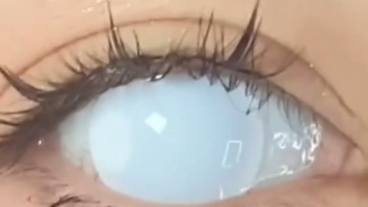 白色盲片/网格/带孔尝试