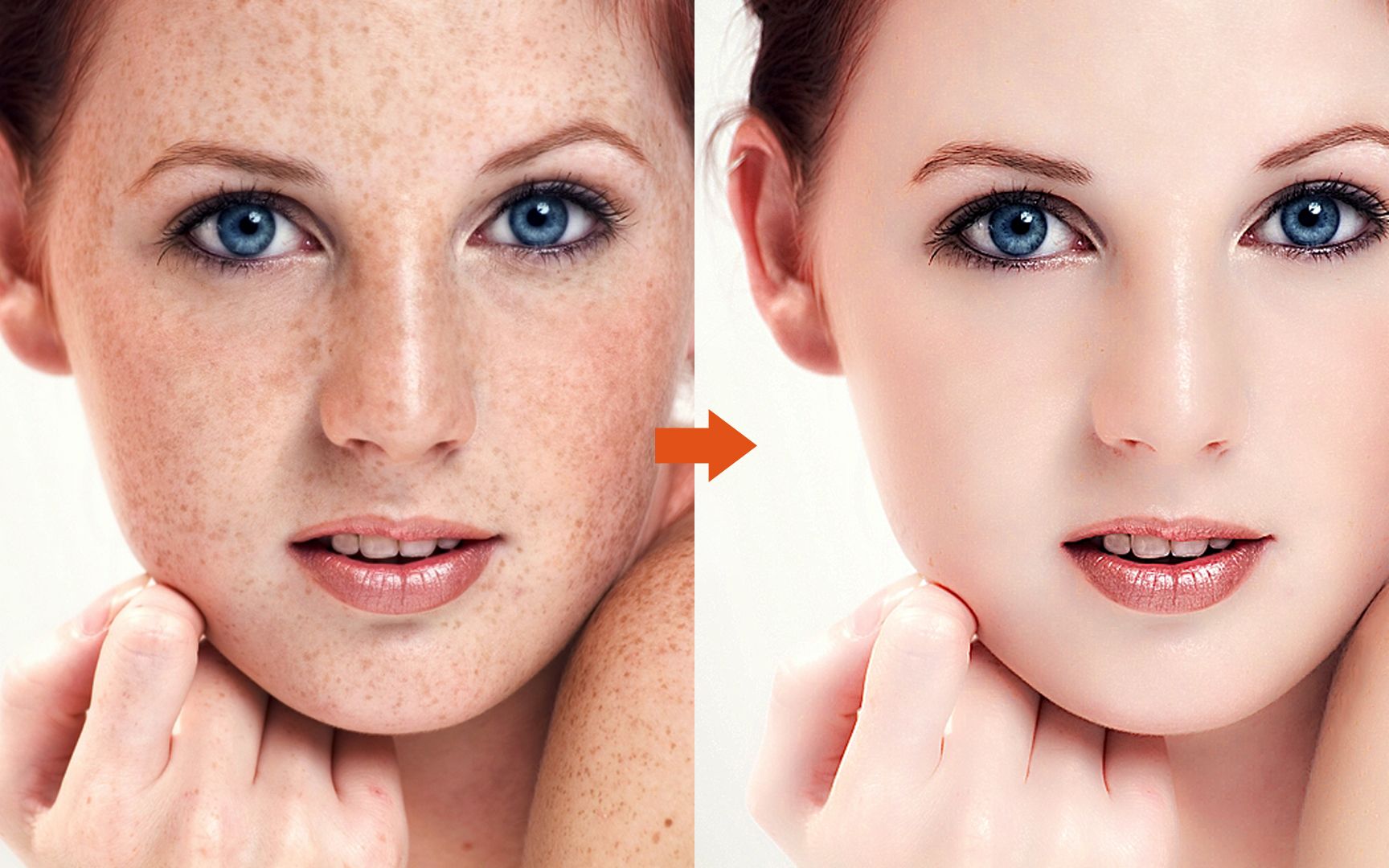 照片修饰新技术不用磨皮也能轻松去除黑斑瑕疵和粉刺疤痕