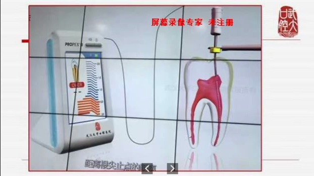 讲测量根管工作长度哔哩哔哩bilibili