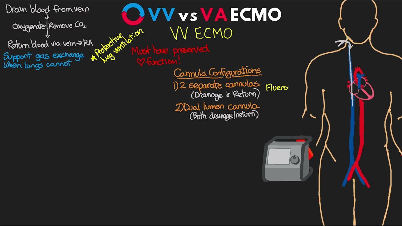 [图]VV vs VA ECMO Explained!