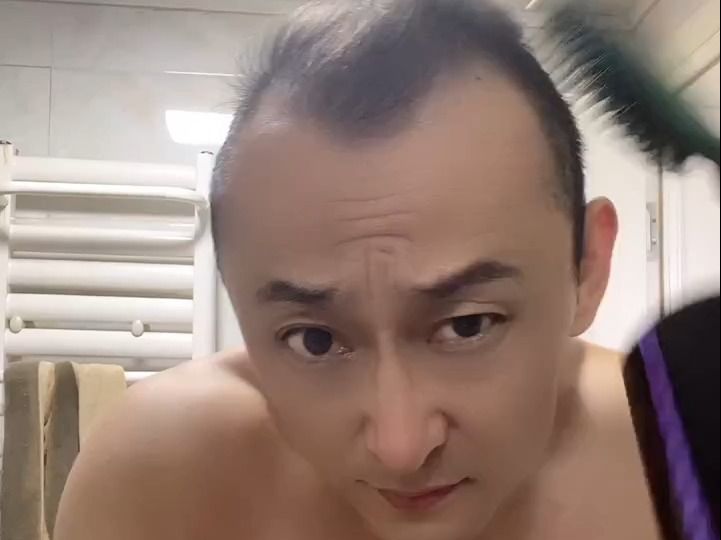 这几根毛还有救吗