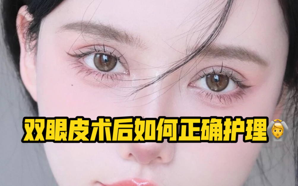 双眼皮术后如何正确护理,快速消肿不留疤!哔哩哔哩bilibili