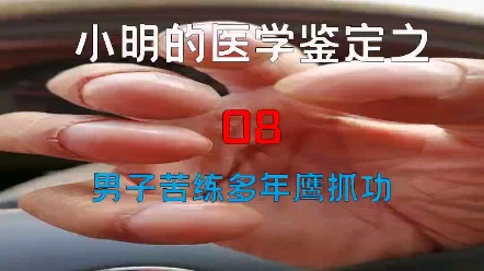 [图]【医学鉴定】网络热门疾病鉴定08