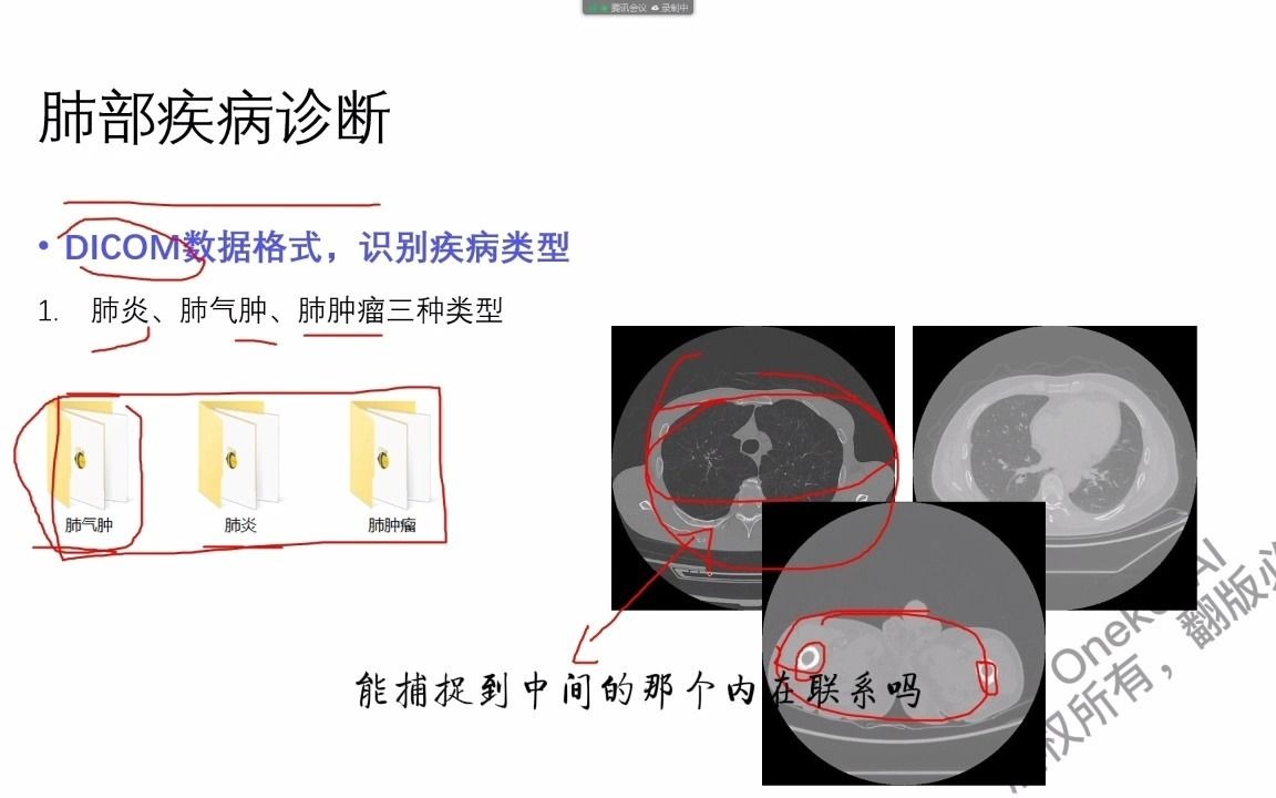 快速解析影像组学中智齿和肺部器官的CT图像分割哔哩哔哩bilibili