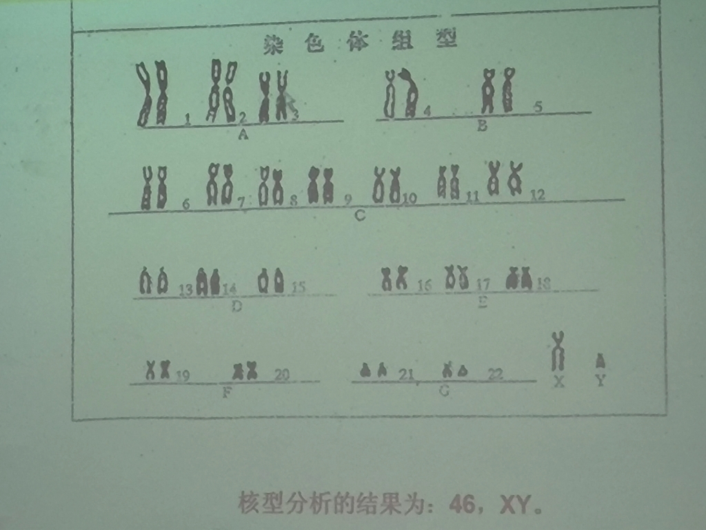 人类染色体核型分析