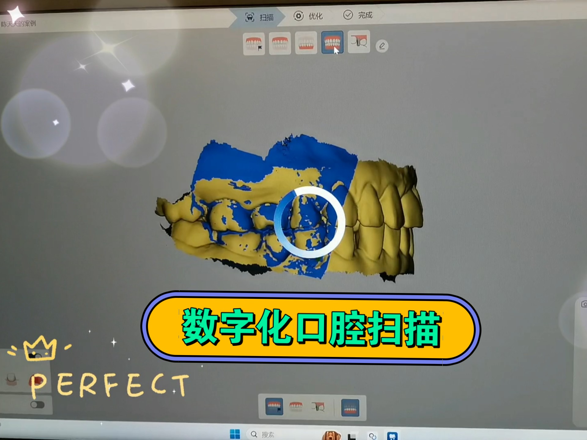 口腔数字化修复技术98课件pptx